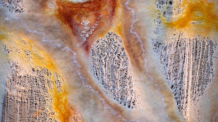 1500 COUPS DE POUCE - Depuis Tarbes, L’Autre Sein qui fait du bien post-cancer